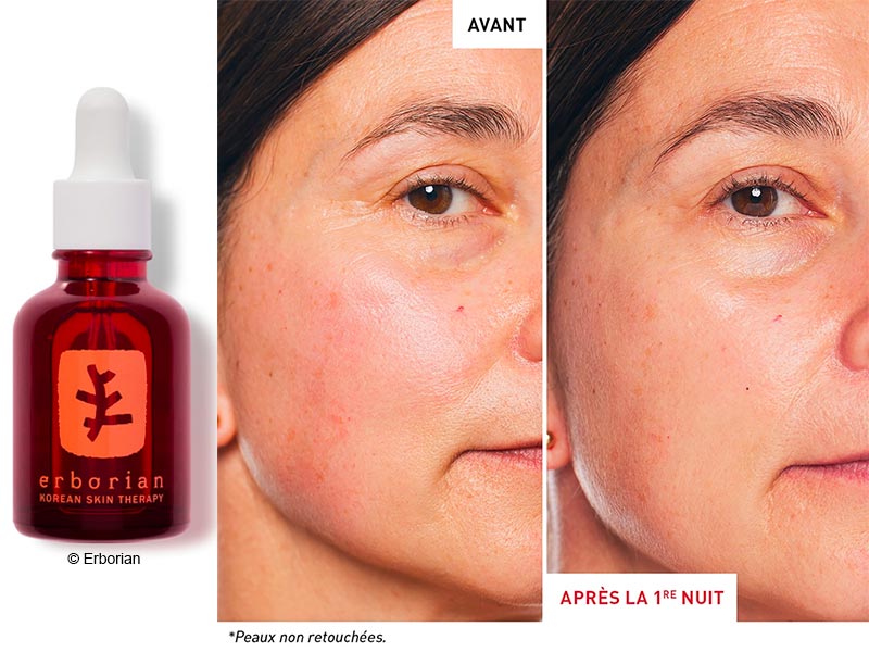 Photo avant après Skin Therapy Erborian