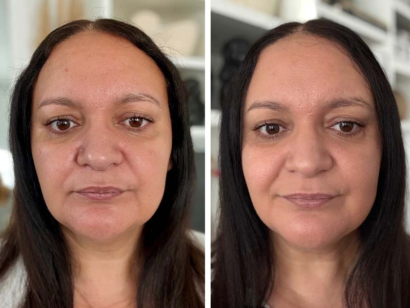 Ma peau avant et après l’utilisation du masque LED CurrentBody Série 3